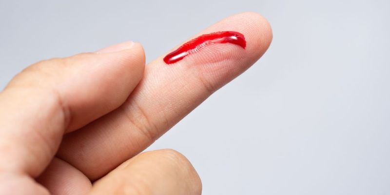 Giải mã mơ thấy máu đánh con gì cực chuẩn